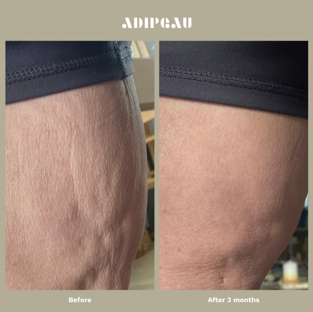 Adipeau Strong Body Gel