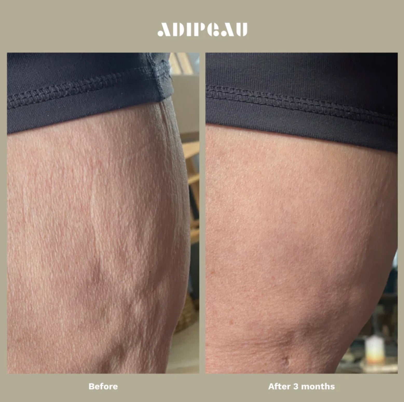 Adipeau Strong Body Gel