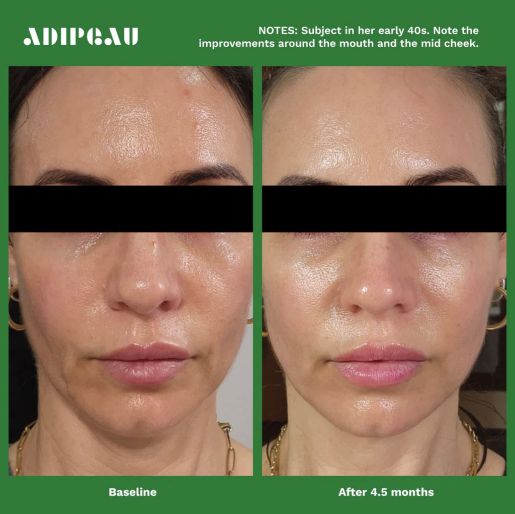 Adipeau Volume Cream